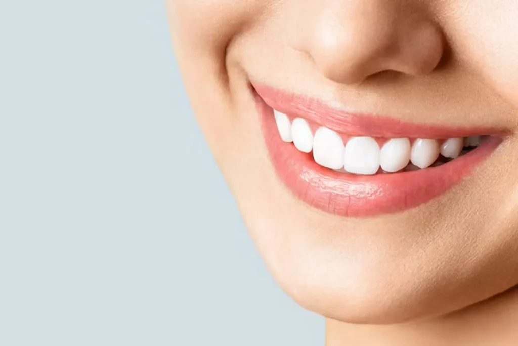 Smile Design