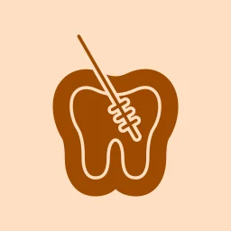 Best RCT Treatment in Hyderabead-Krishna Dental Hospital